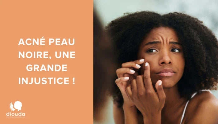 les causes de l acne sur Peau noire 